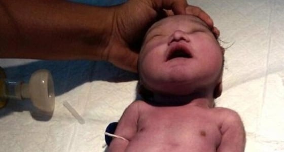 بالصور.. سيدة تلد " حورية بحر "