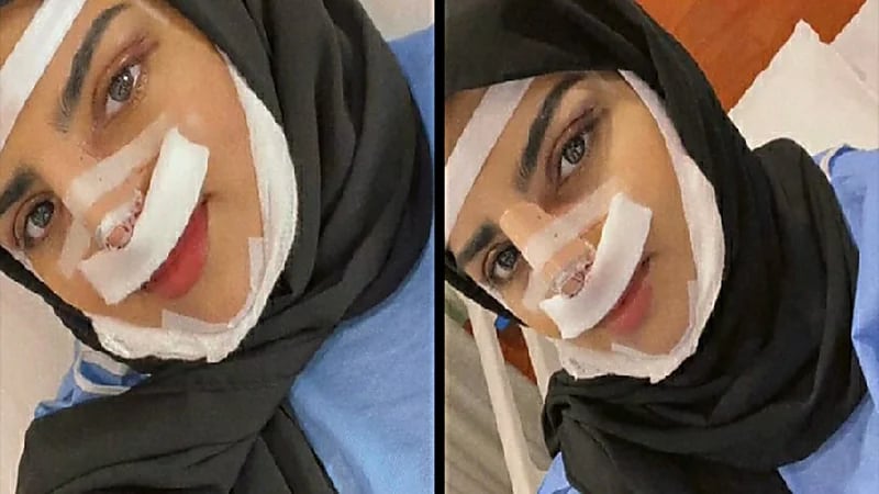 بالصور.. سارة الودعاني تخضع لجراحة تجميلية