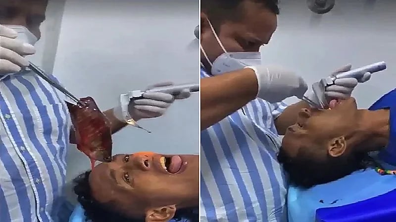 بالصور.. سمكة تقتحم حلق شاب