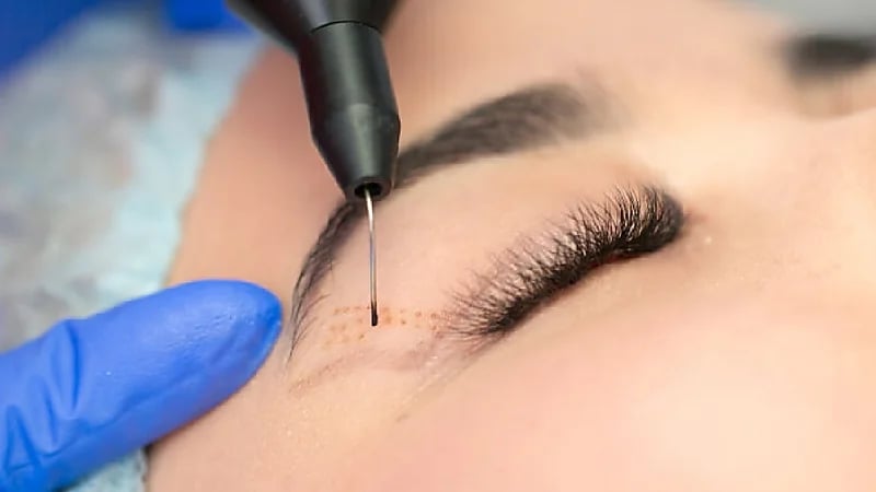 بالفيديو.. استشاري يوضح 3 فحوصات يجب إجراءها قبل عمليات تجميل الجفون