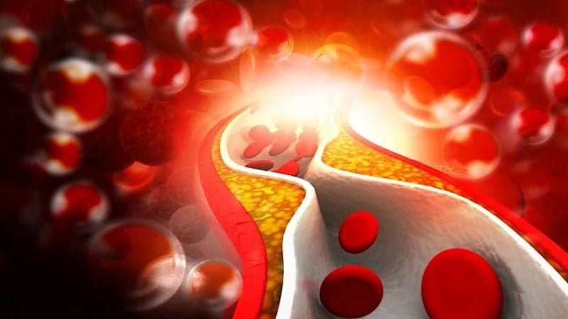 سعود الطبية توضح كيفية التحكم في كوليسترول الدم