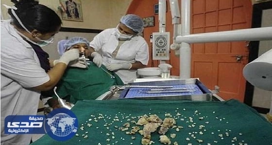 بالصور.. استخراج 232 سناً من فم مراهق