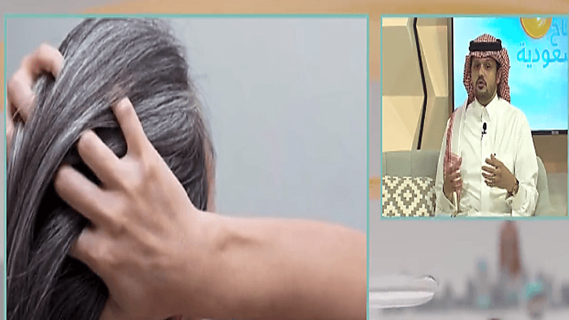 "سعود العبيداء " يوضح هل صبغات الشعر لها علاقة في ظهور الشيب (فيديو)