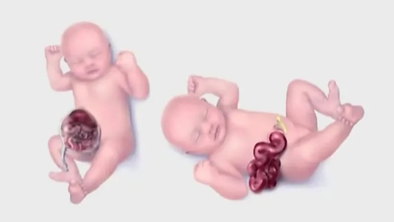 بالفيديو.. استشاري يوضح أبرز أسباب التشوهات الخلقية في الحمل ودور الأم فيها