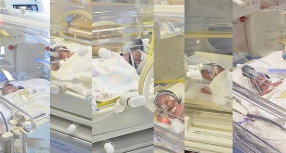 في حالة نادرة..أم لأربع أطفال تلد 6 توائم