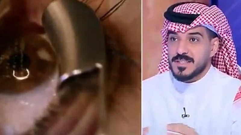 استشاري: لا أنصح بإجراء عملية تغيير لون عدسة العين لقلة نسبة الأمان فيها (فيديو)