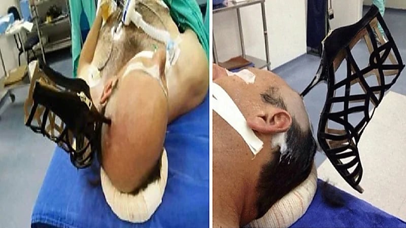 حقيقة ضرب امرأة لزوجها وإصابته في رأسه بالجبيل