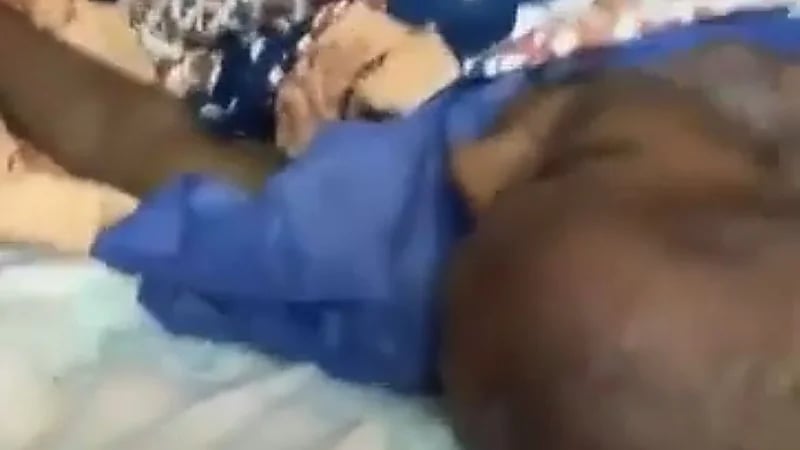 بالفيديو.. مصعد كهربائي يسقط بمريض في طريقه لإجراء عملية قلب مفتوح