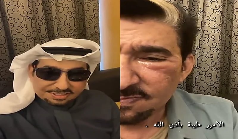 شاهد.. السدحان يصدم جمهوره بوجه منتفخ 
