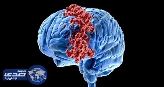 دراسة أمريكية: فيروس " زيكا " يساعد في علاج السرطان