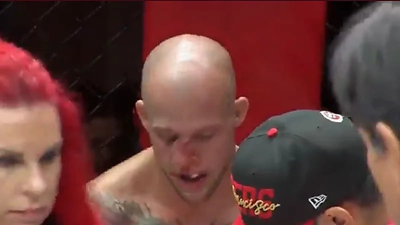 شاهد .. لحظة تلقي المقاتل بليك بيري ضربة قوية أدت لتشوّه أنفه