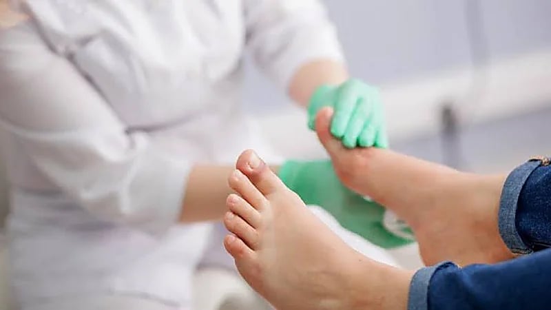 استشاري: أظافرك قد تنبهك بمرض خطير ومميت