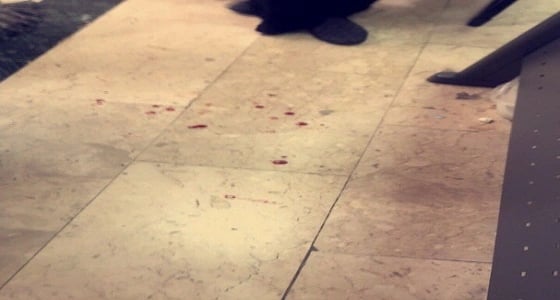 وقوع مضاربة جماعية بين طالبات باستخدام المشارط في جامعة الطائف