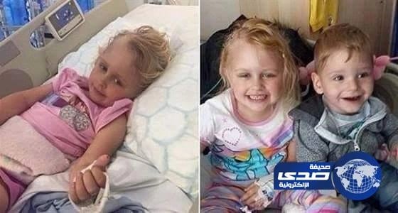 مآساة طفلة تحول عظامها إلى تراب