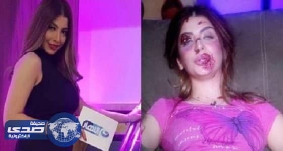 مذيعة تتعرض لحادث أليم اثناء محاولة أثبات قدرة المرأة على القيادة