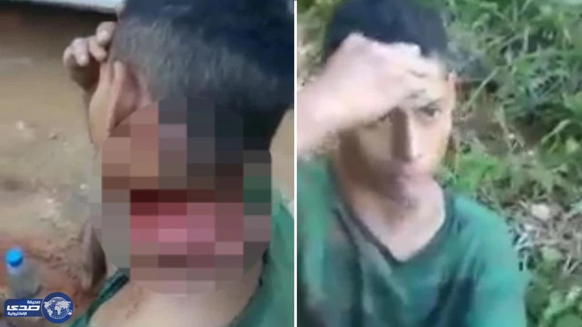 بالفيديو.. برازيلي يسير برأسه شبه مقطوعه بالشارع