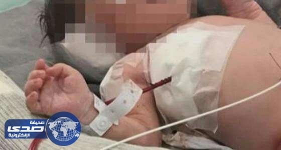 العناية الإلهية تنقذ جنين تلقى رصاصة وهو في رحم أمه