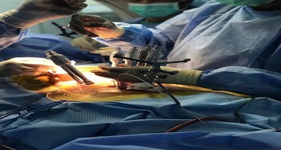 نجاح عملية تثبيت كسر بالفقرة القطنية الأولى في مجمع الدمام الطبي