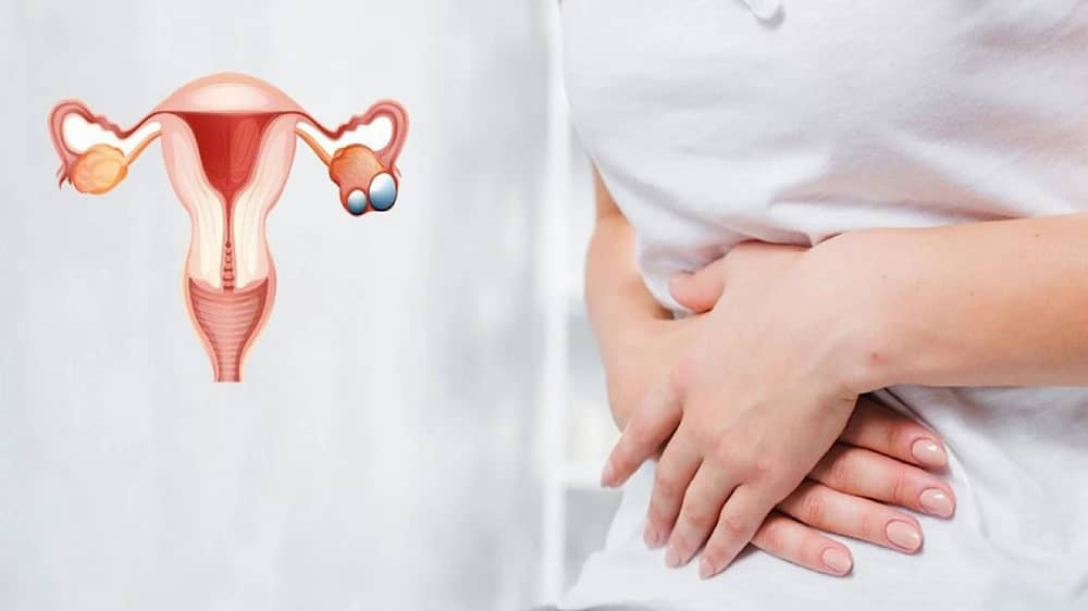 4 توابل تساعد في علاج متلازمة تكيس المبايض